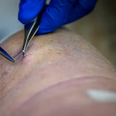 Dermatology procedure and skin care